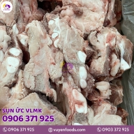 SỤN ỨC VLMK