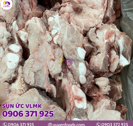 SỤN ỨC VLMK